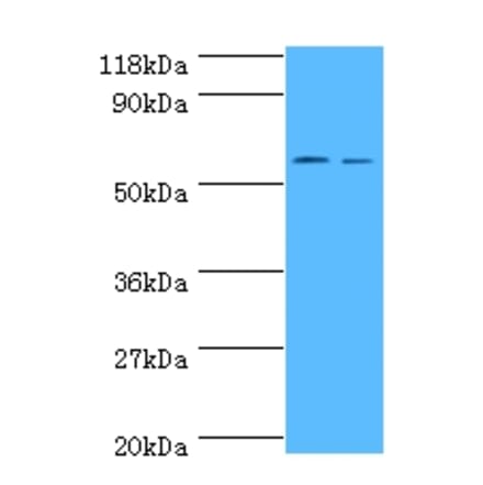Carboxylesterase 1C Polyclonal Antibody from Signalway Antibody (42632) - Antibodies.com