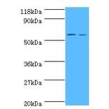 Carboxylesterase 1C Polyclonal Antibody from Signalway Antibody (42632) - Antibodies.com