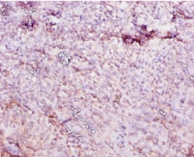 Immunohistochemistry - Carboxylesterase 1C Polyclonal Antibody from Signalway Antibody (42632) - Antibodies.com