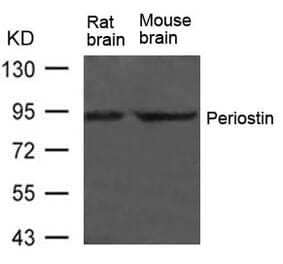 Western blot - Periostin Antibody from Signalway Antibody (21451) - Antibodies.com