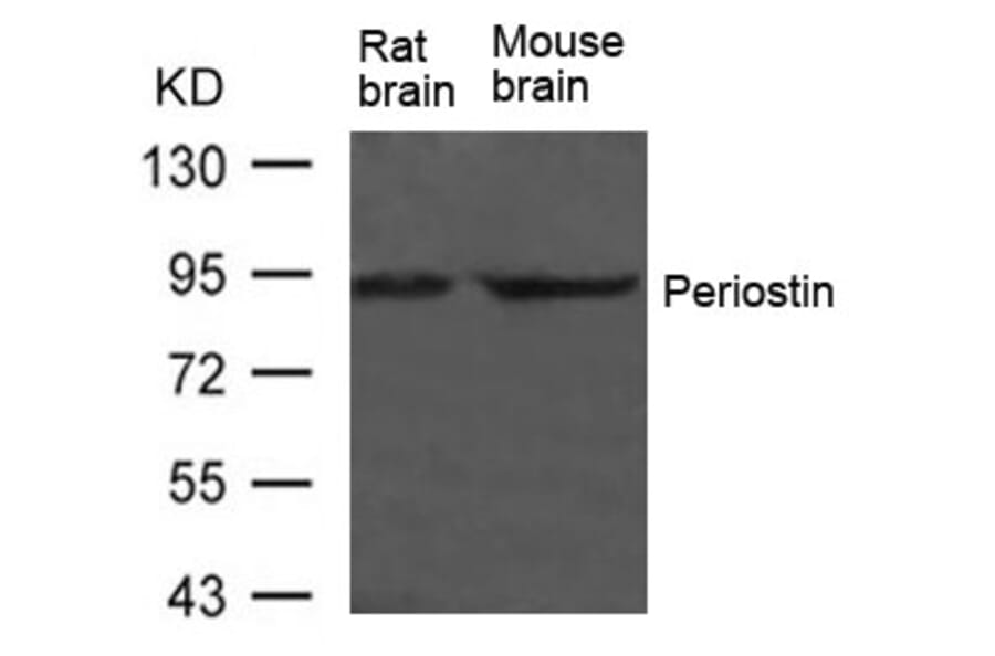 Western blot - Periostin Antibody from Signalway Antibody (21451) - Antibodies.com