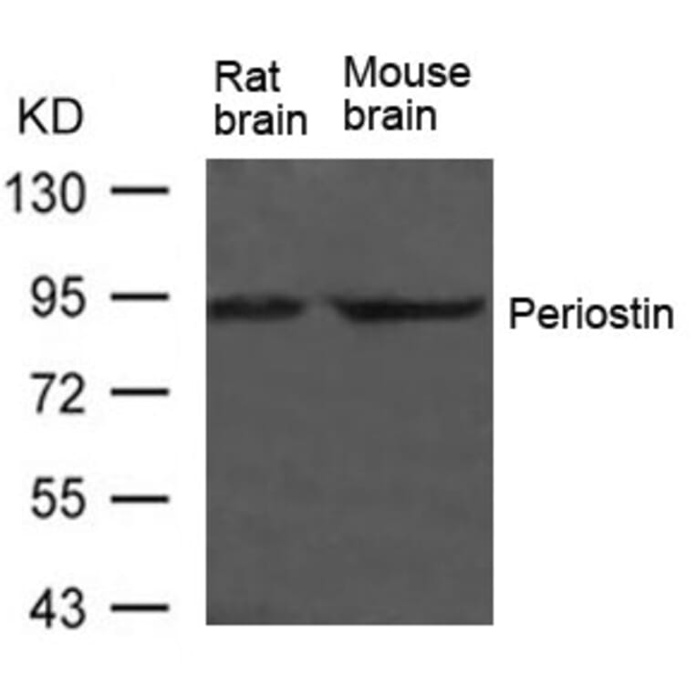 Western blot - Periostin Antibody from Signalway Antibody (21451) - Antibodies.com