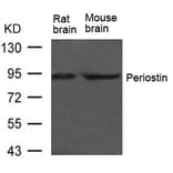 Western blot - Periostin Antibody from Signalway Antibody (21451) - Antibodies.com