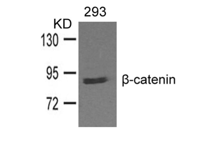 Western blot - b-catenin Antibody from Signalway Antibody (21574) - Antibodies.com