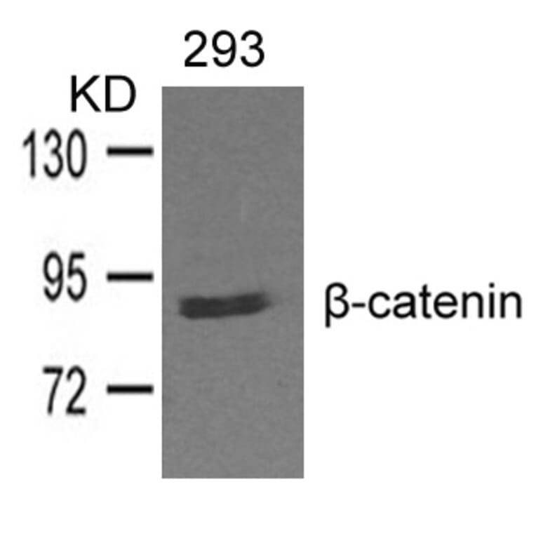 Western blot - b-catenin Antibody from Signalway Antibody (21574) - Antibodies.com
