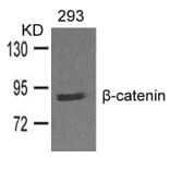 Western blot - b-catenin Antibody from Signalway Antibody (21574) - Antibodies.com
