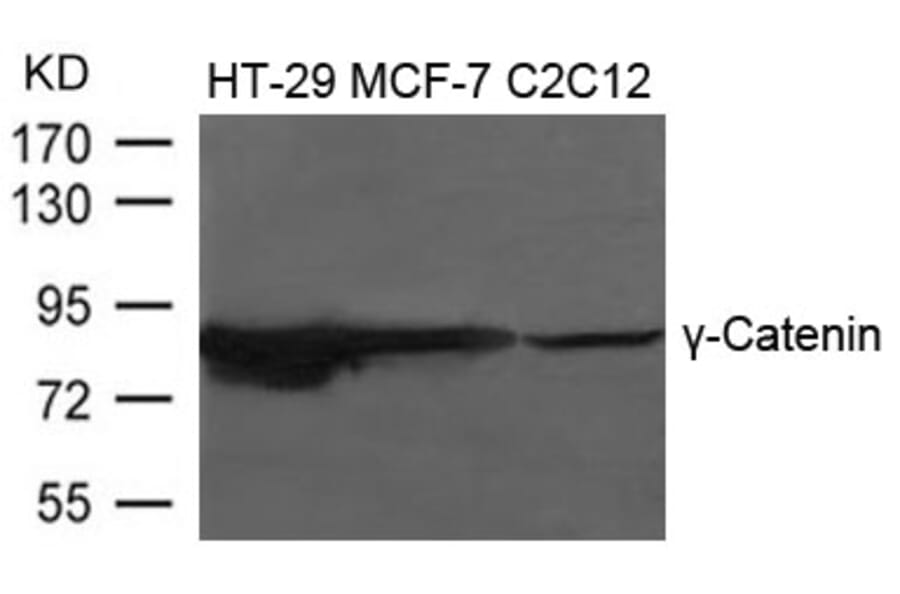 Western blot - g-Catenin Antibody from Signalway Antibody (21645) - Antibodies.com