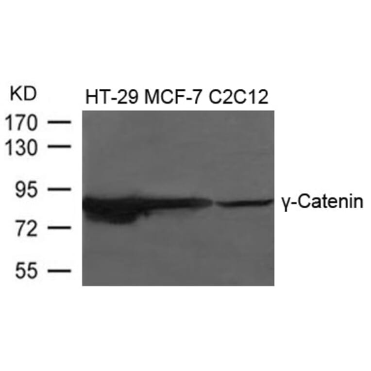 Western blot - g-Catenin Antibody from Signalway Antibody (21645) - Antibodies.com