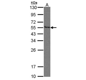 Nectin 2 antibody from Signalway Antibody (22110) - Antibodies.com