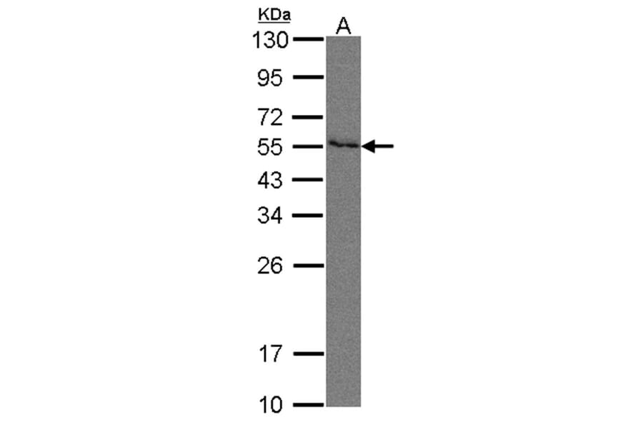Nectin 2 antibody from Signalway Antibody (22110) - Antibodies.com