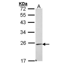 Endomucin antibody from Signalway Antibody (22404) - Antibodies.com