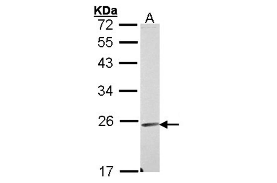 Endomucin antibody from Signalway Antibody (22404) - Antibodies.com