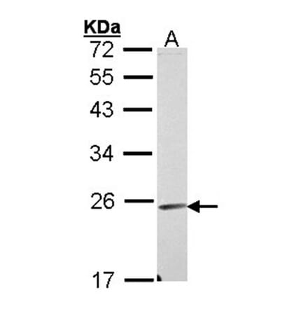 Endomucin antibody from Signalway Antibody (22404) - Antibodies.com