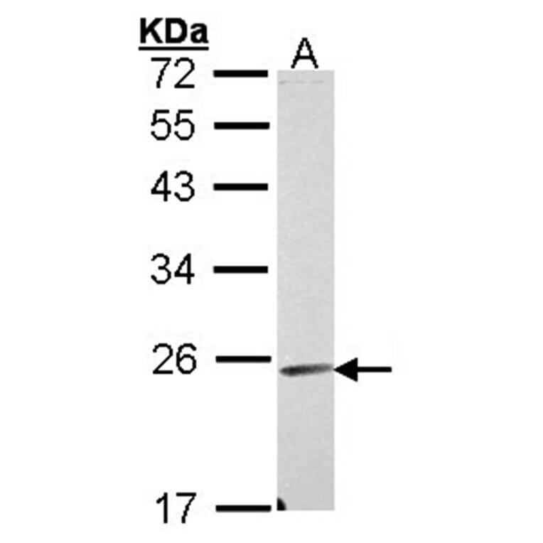 Endomucin antibody from Signalway Antibody (22404) - Antibodies.com