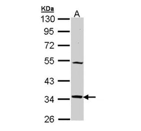 MEL-1A-R antibody from Signalway Antibody (22438) - Antibodies.com