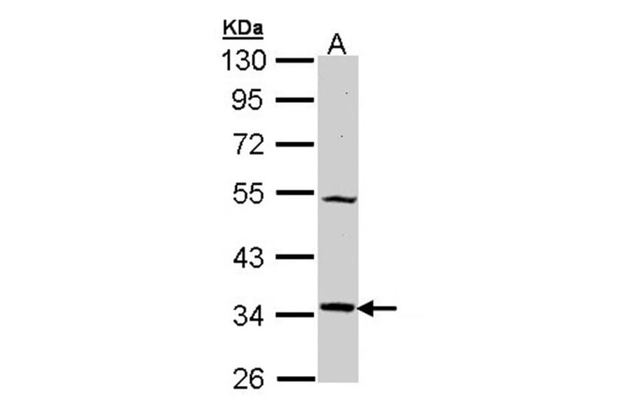 MEL-1A-R antibody from Signalway Antibody (22438) - Antibodies.com