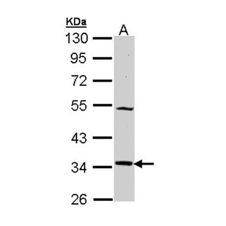 MEL-1A-R antibody from Signalway Antibody (22438) - Antibodies.com
