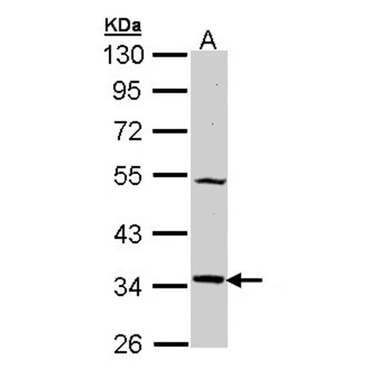 MEL-1A-R antibody from Signalway Antibody (22438) - Antibodies.com