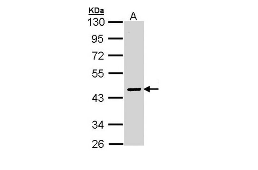 SERPINA10 antibody from Signalway Antibody (22737) - Antibodies.com