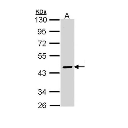 SERPINA10 antibody from Signalway Antibody (22737) - Antibodies.com