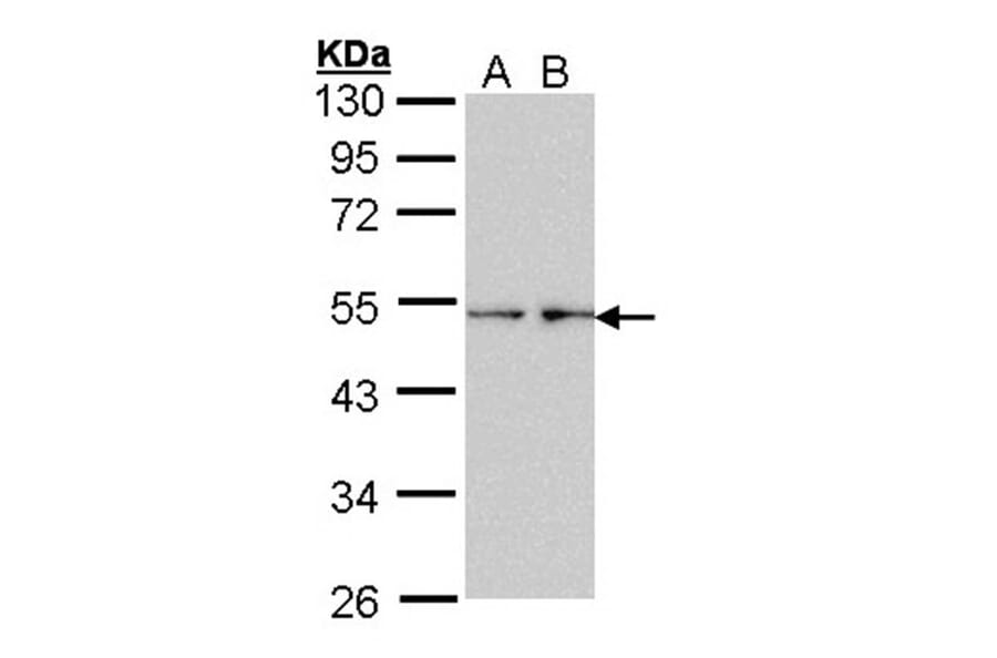 Fascin 1 antibody from Signalway Antibody (22918) - Antibodies.com