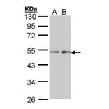 Fascin 1 antibody from Signalway Antibody (22918) - Antibodies.com