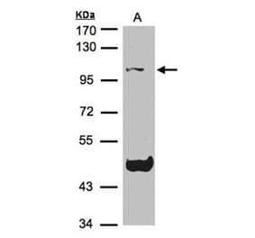 Cryopyrin antibody from Signalway Antibody (23163) - Antibodies.com