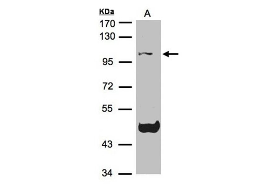Cryopyrin antibody from Signalway Antibody (23163) - Antibodies.com