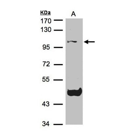 Cryopyrin antibody from Signalway Antibody (23163) - Antibodies.com