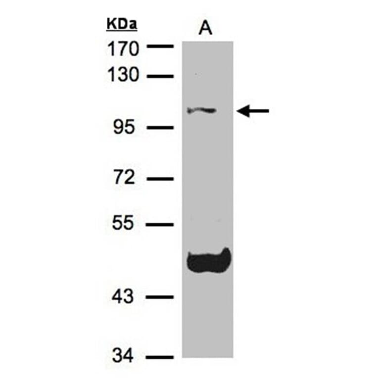 Cryopyrin antibody from Signalway Antibody (23163) - Antibodies.com