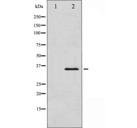 Western blot - IkB-alpha Antibody from Signalway Antibody (29054) - Antibodies.com