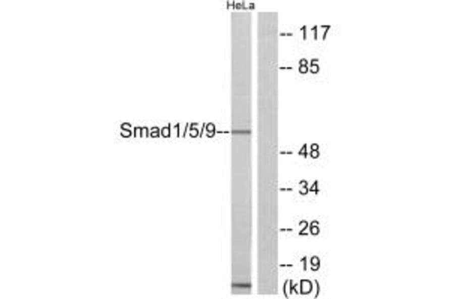 Western blot - Smad1/5/9 Antibody from Signalway Antibody (33909) - Antibodies.com
