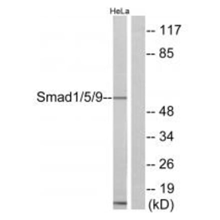 Western blot - Smad1/5/9 Antibody from Signalway Antibody (33909) - Antibodies.com