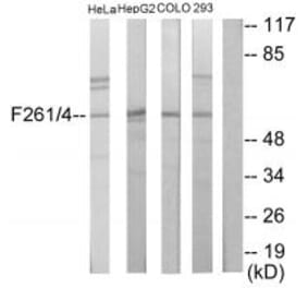 Western blot - PFKFB1/4 Antibody from Signalway Antibody (33917) - Antibodies.com