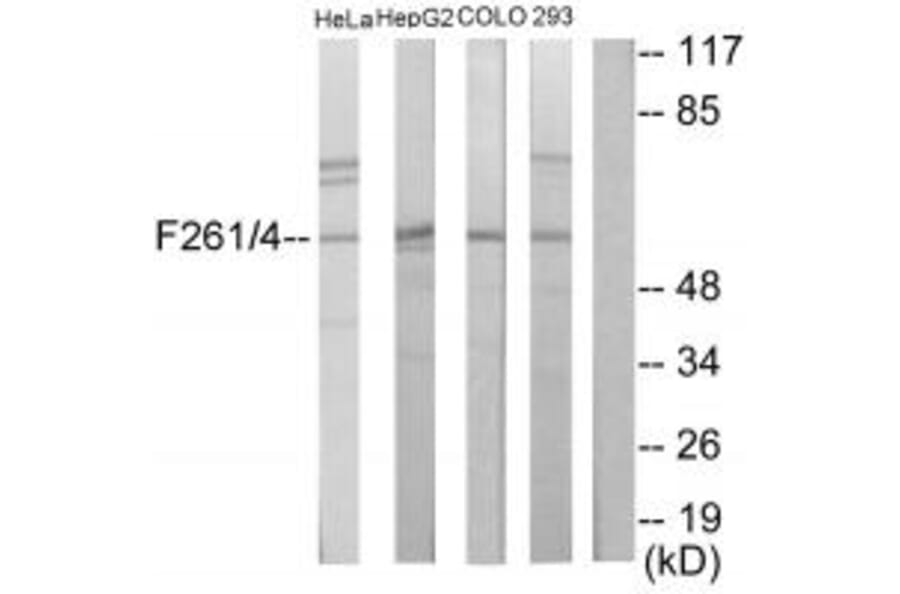 Western blot - PFKFB1/4 Antibody from Signalway Antibody (33917) - Antibodies.com