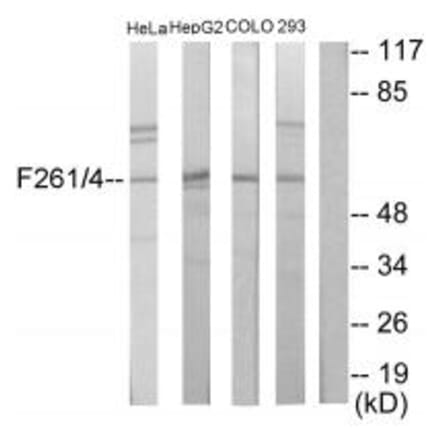 Western blot - PFKFB1/4 Antibody from Signalway Antibody (33917) - Antibodies.com