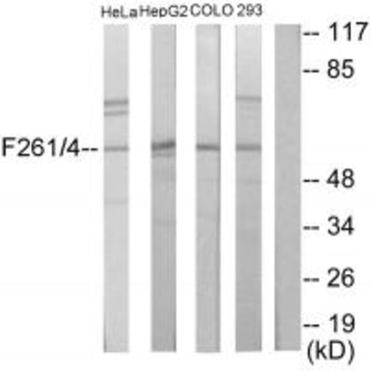 Western blot - PFKFB1/4 Antibody from Signalway Antibody (33917) - Antibodies.com