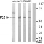 Western blot - PFKFB1/4 Antibody from Signalway Antibody (33917) - Antibodies.com