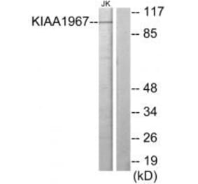 Western blot - KIAA1967 Antibody from Signalway Antibody (33965) - Antibodies.com