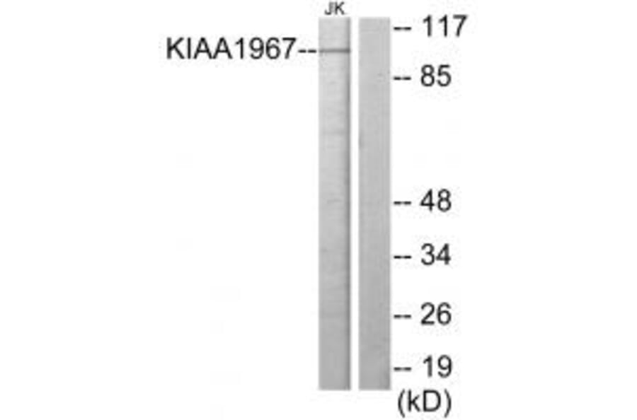Western blot - KIAA1967 Antibody from Signalway Antibody (33965) - Antibodies.com