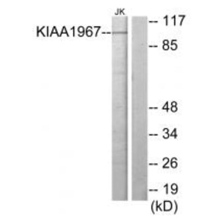 Western blot - KIAA1967 Antibody from Signalway Antibody (33965) - Antibodies.com