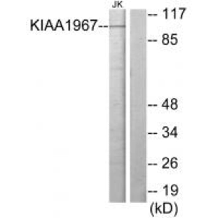 Western blot - KIAA1967 Antibody from Signalway Antibody (33965) - Antibodies.com