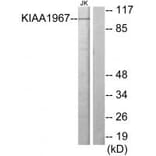Western blot - KIAA1967 Antibody from Signalway Antibody (33965) - Antibodies.com