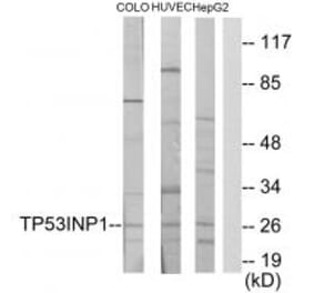 Western blot - TP53INP1 Antibody from Signalway Antibody (34022) - Antibodies.com