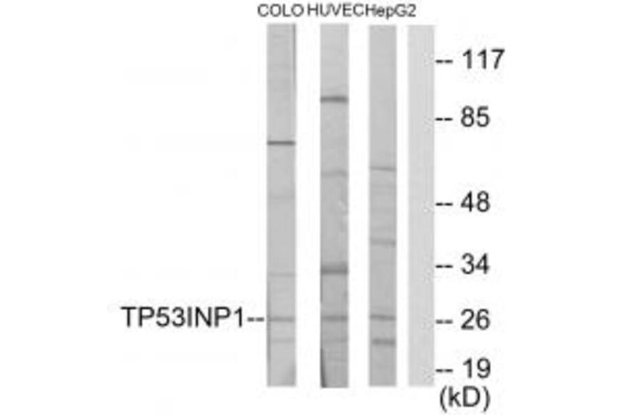 Western blot - TP53INP1 Antibody from Signalway Antibody (34022) - Antibodies.com