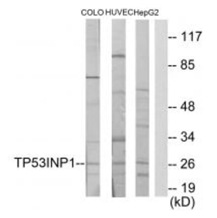 Western blot - TP53INP1 Antibody from Signalway Antibody (34022) - Antibodies.com