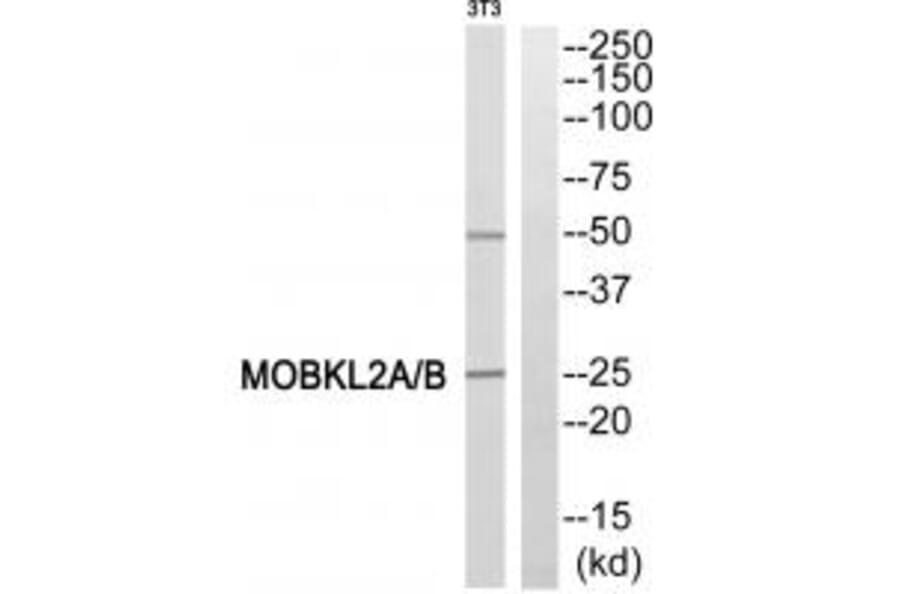 Western blot - MOBKL2A/B Antibody from Signalway Antibody (34025) - Antibodies.com