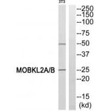 Western blot - MOBKL2A/B Antibody from Signalway Antibody (34025) - Antibodies.com