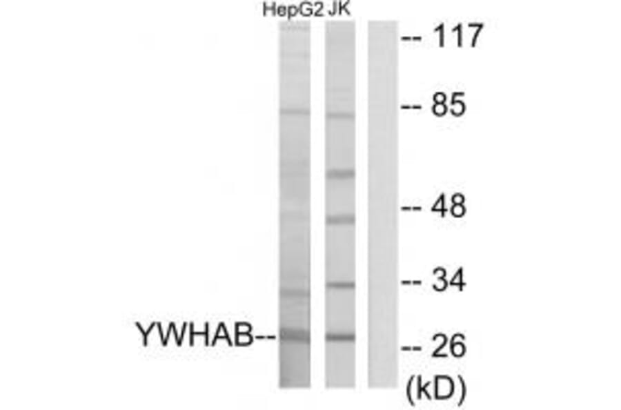 Western blot - 14-3-3 β Antibody from Signalway Antibody (34144) - Antibodies.com