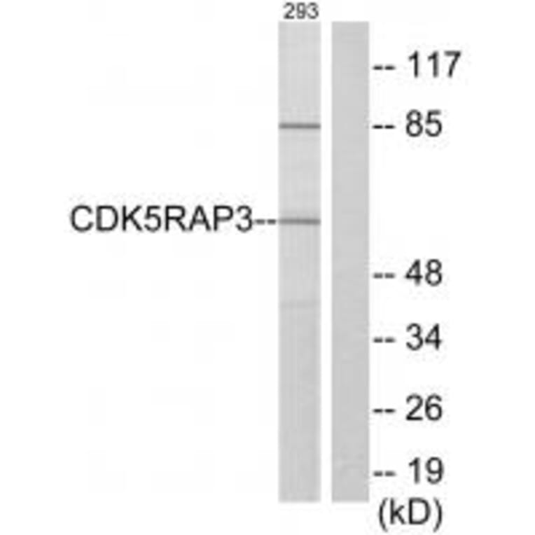 Western blot - CDK5RAP3 Antibody from Signalway Antibody (34200) - Antibodies.com